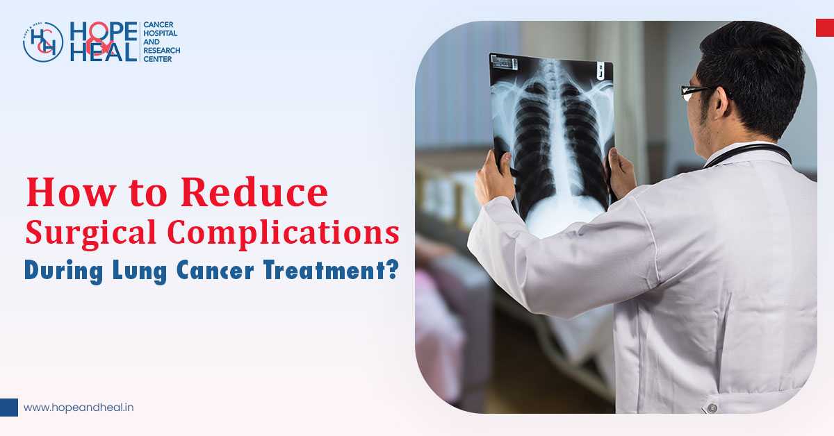 How to Reduce Surgical Complications During Lung Cancer Treatment