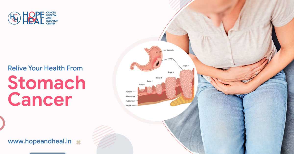 The Best Hospital For Stomach Cancer