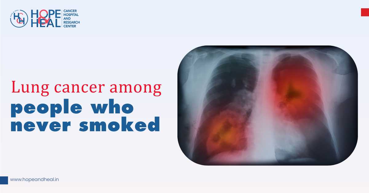 Lung Cancer Among People Who Never Smoked