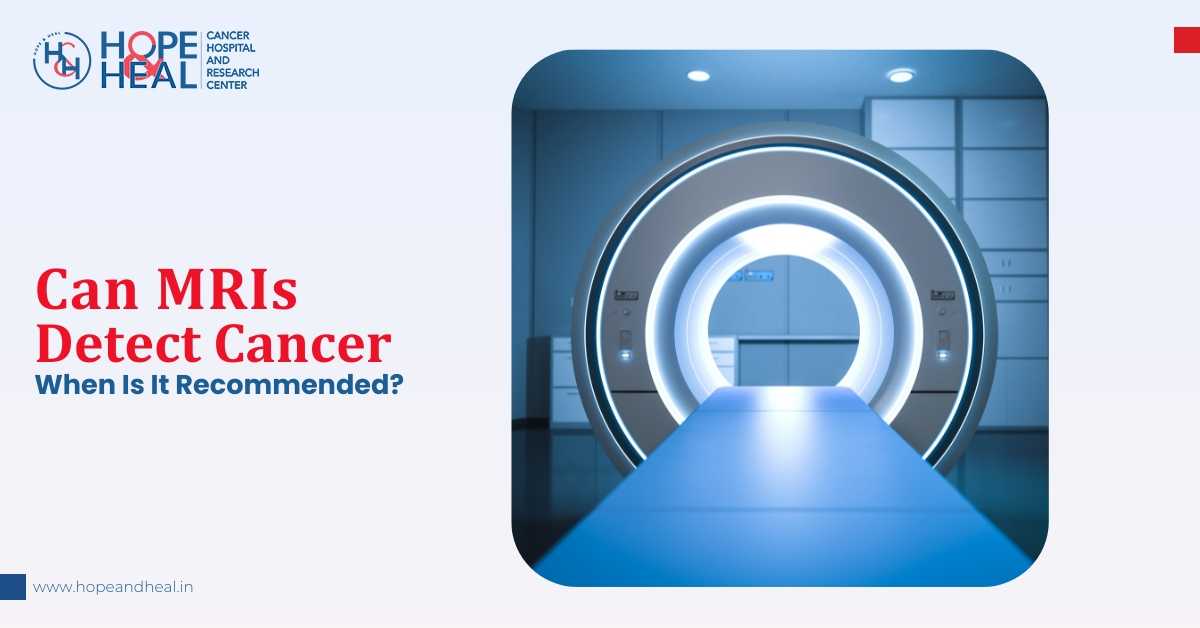 Can MRIs Detect Cancer? When Is It Recommended?