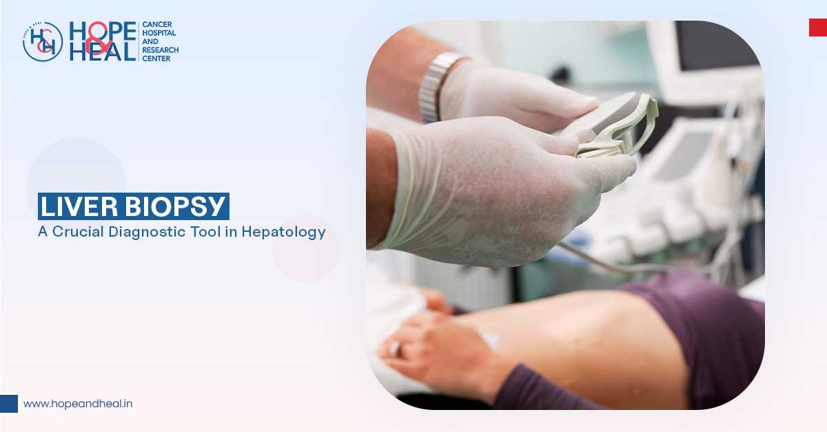 Liver Biopsy: A Crucial Diagnostic Tool in Hepatology