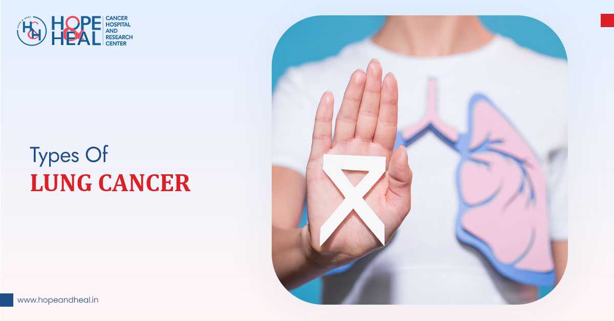 4 Common Types Of Lung Cancer Explained