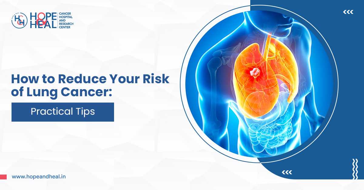 How to Reduce Your Risk of Lung Cancer: Practical Tips