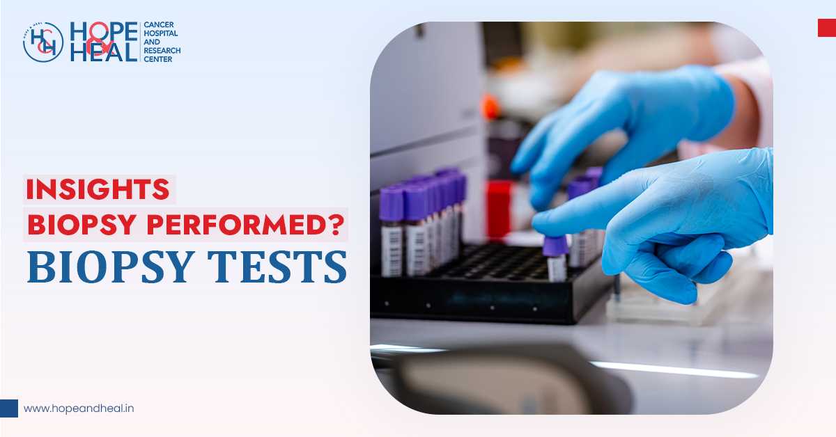 Insights Into The Types Of Biopsy Tests