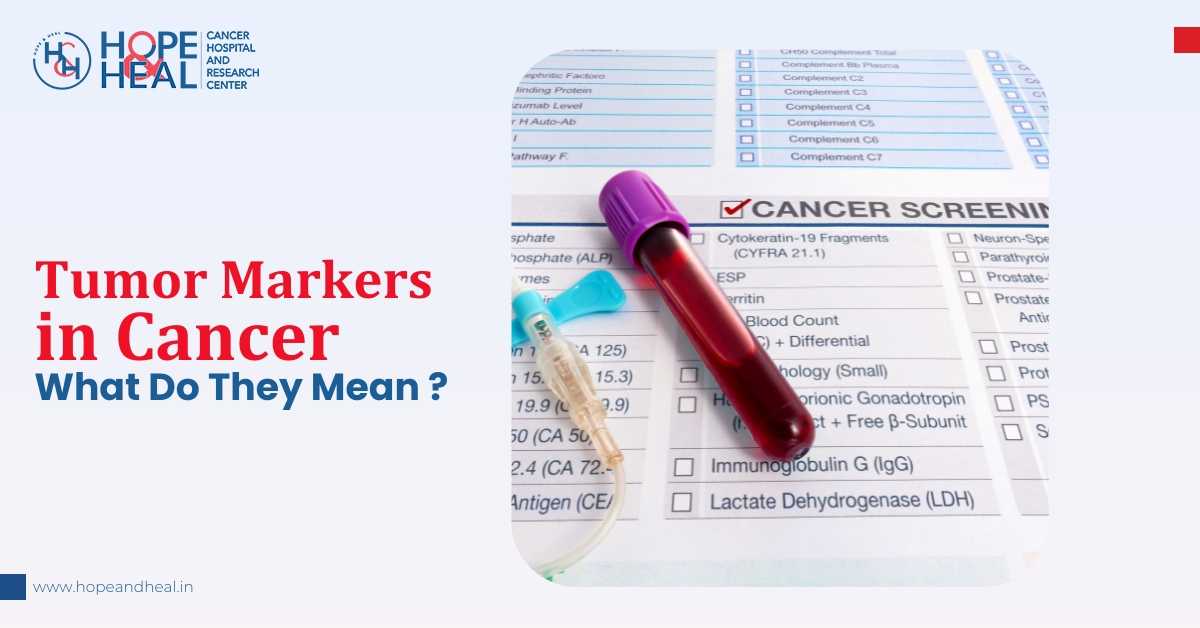 Tumor Markers in Cancer: What Do They Mean?