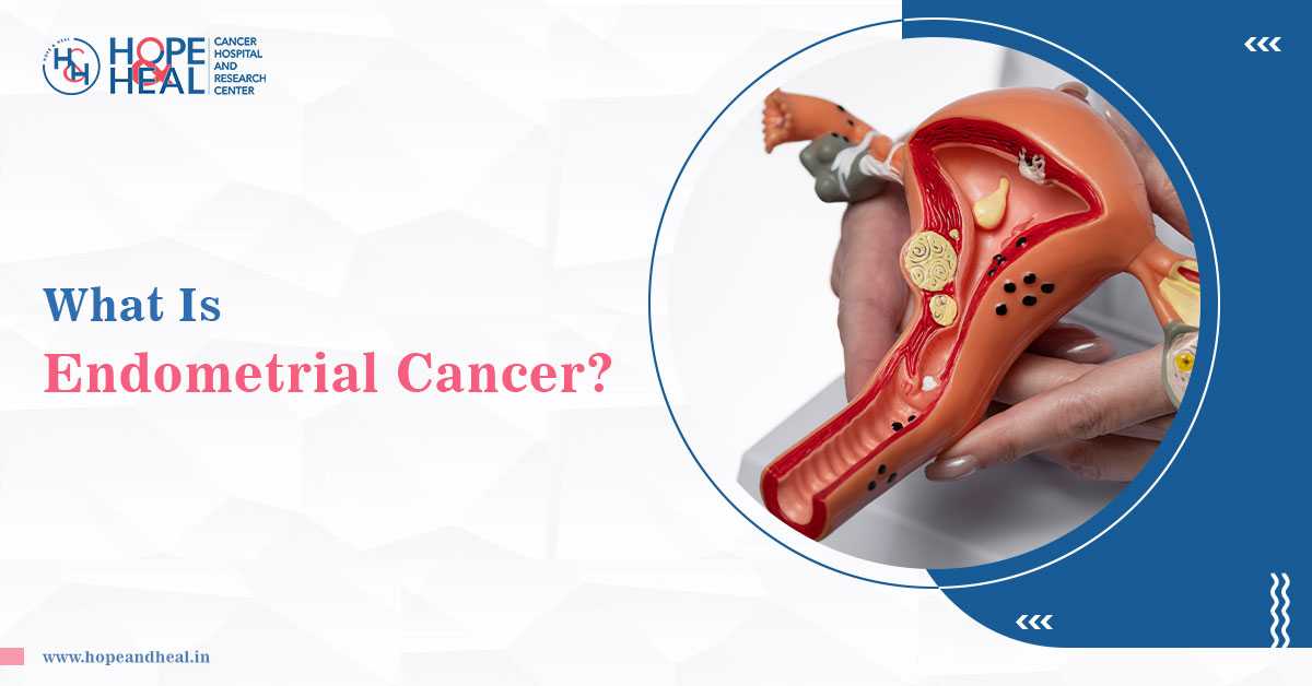 Signs And Risk Factors For Endometrial Cancer