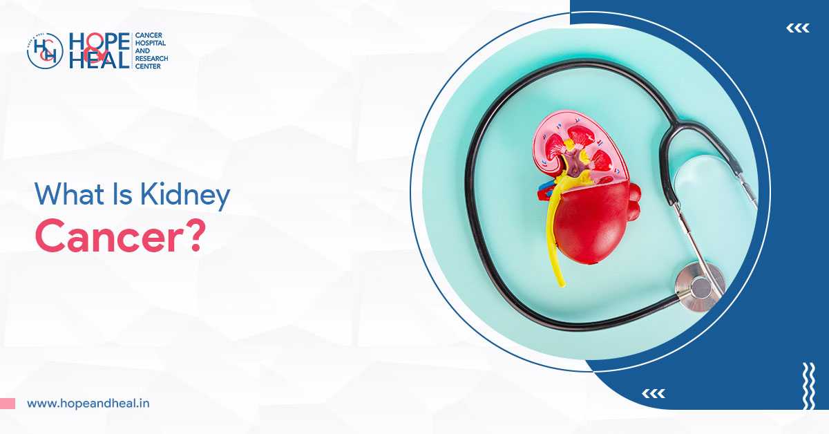 Risk Factors & Prevention For Kidney Cancer