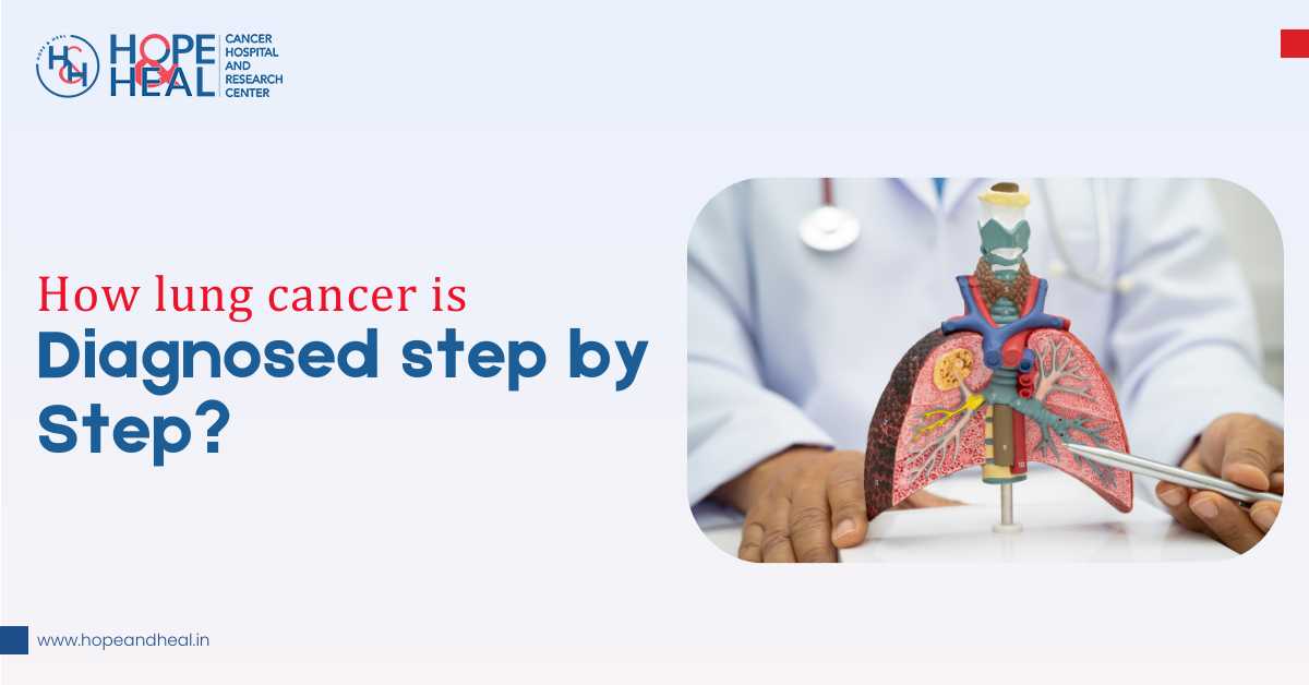 How Lung Cancer is Diagnosed Step by Step