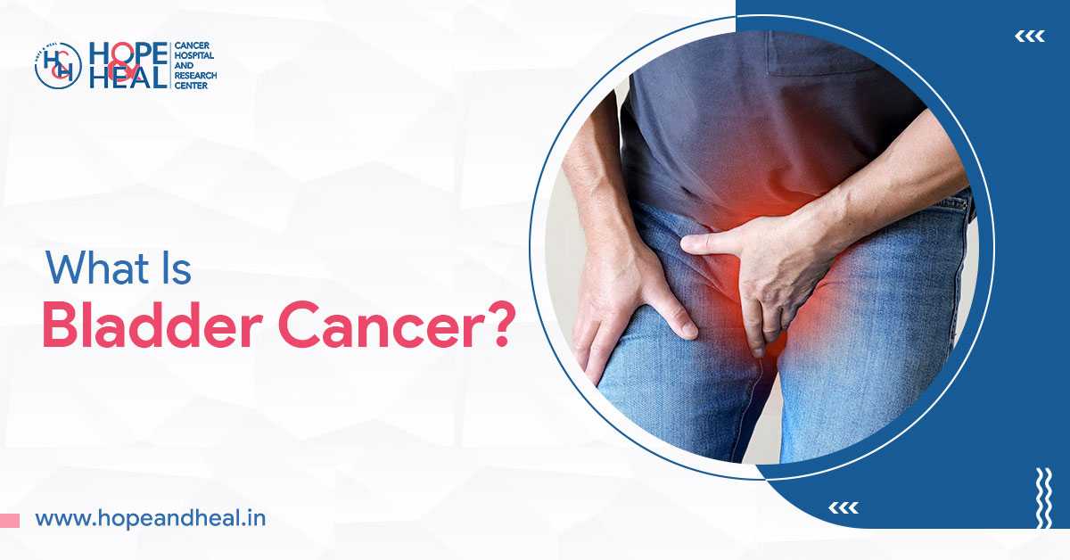 Bladder Cancer – Signs, Prevention & Medical Care