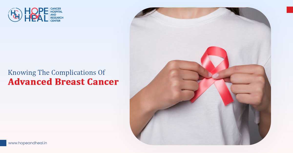 Knowing The Complications Of Advanced Breast Cancer