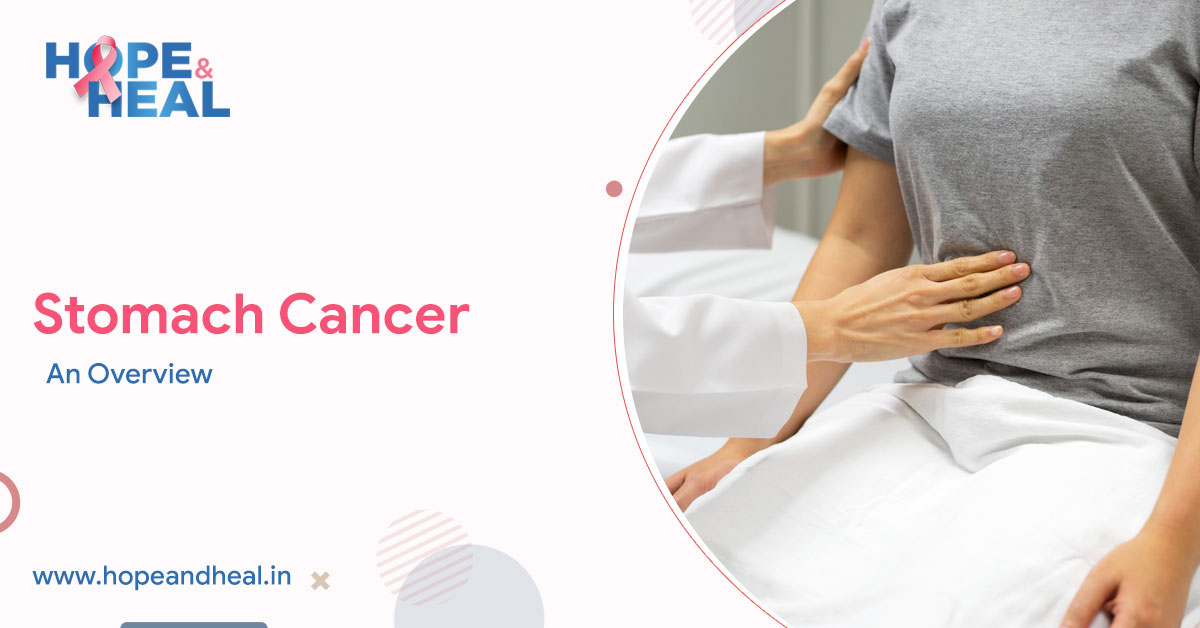 Stomach Cancer