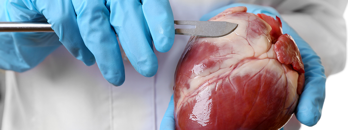 Liver Resection - Services - Hope & Heal Cancer Hospital and Research Center