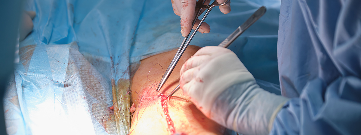 Radical Hemicolectomy - Services - Hope & Heal Cancer Hospital and Research Center