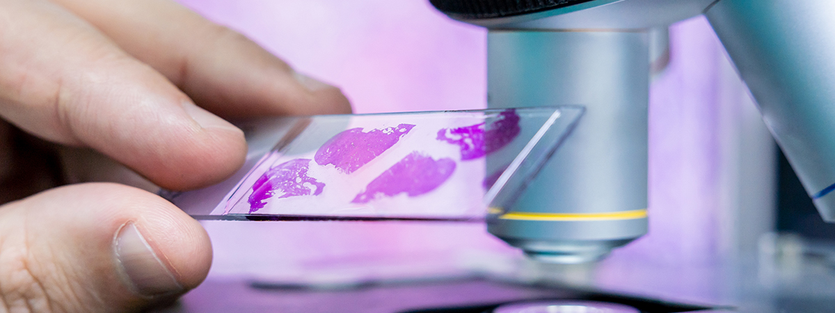 Image Guided Biopsies - Hope & Heal Cancer Hospital and Research Center