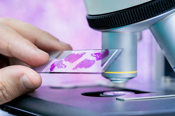 Image Guided Biopsies - Hope & Heal Cancer Hospital and Research Center