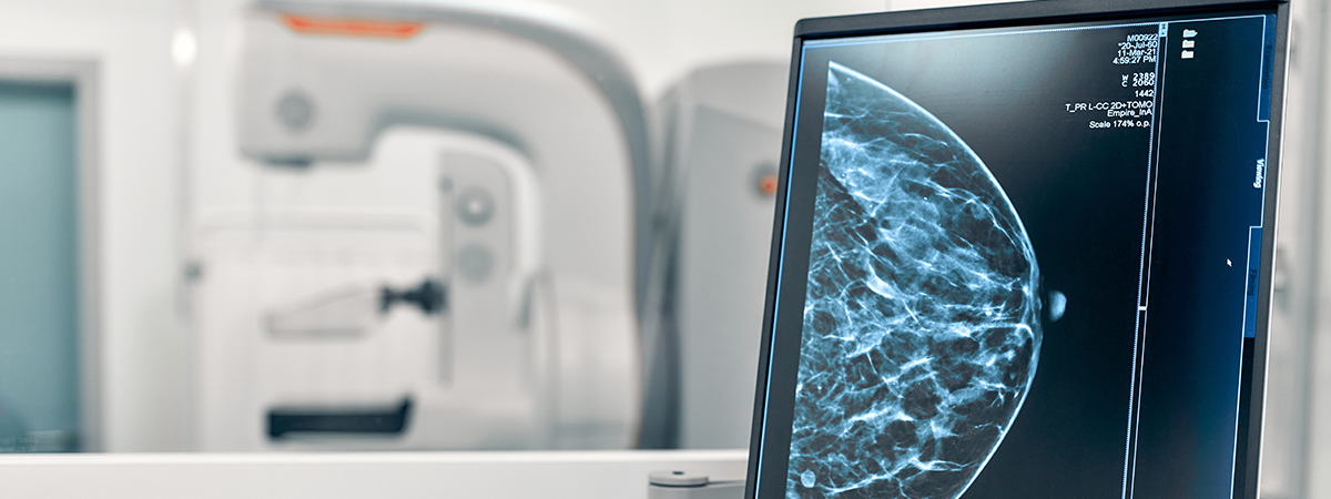 CT Scan - Hope & Heal Cancer Hospital and Research Center