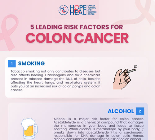 5 Leading Risk Factors for Colon Cancer